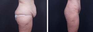 | Dr. Shaun Parson Plastic Surgery Scottsdale Arizona