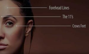 Botox and Dermal Fillers | Dr. Shaun Parson Plastic Surgery Scottsdale