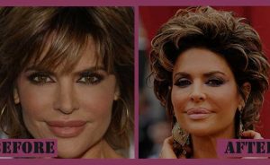 Too Much Plastic Surgery | Dr. Shaun Parson Plastic Surgery Scottsdale