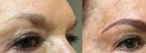 Scottsdale Microblading Treatment | Dr. Shaun Parson Medical Day Spa
