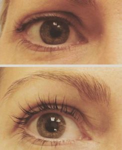Eyelash Perm and Tint Patient 1 | Dr. Shaun Parson Skin Center