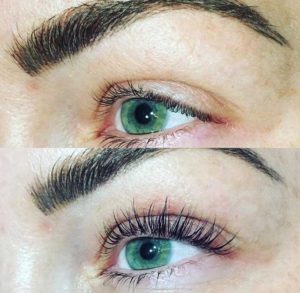 Eyelash Perm and Tint Patient 4 | Parson Skin Center and MediSpa, Scottsdale