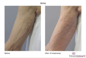 Venus Legacy | Dr. Shaun Parson, Scottsdale