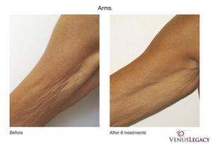Venus Legacy | Dr. Shaun Parson, Scottsdale