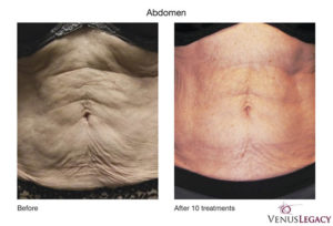 Venus Legacy | Dr. Shaun Parson, Scottsdale