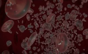 Video Microneedling with PRP | Dr. Shaun Parson Plastic Surgery and Skin Center, Scottsdale
