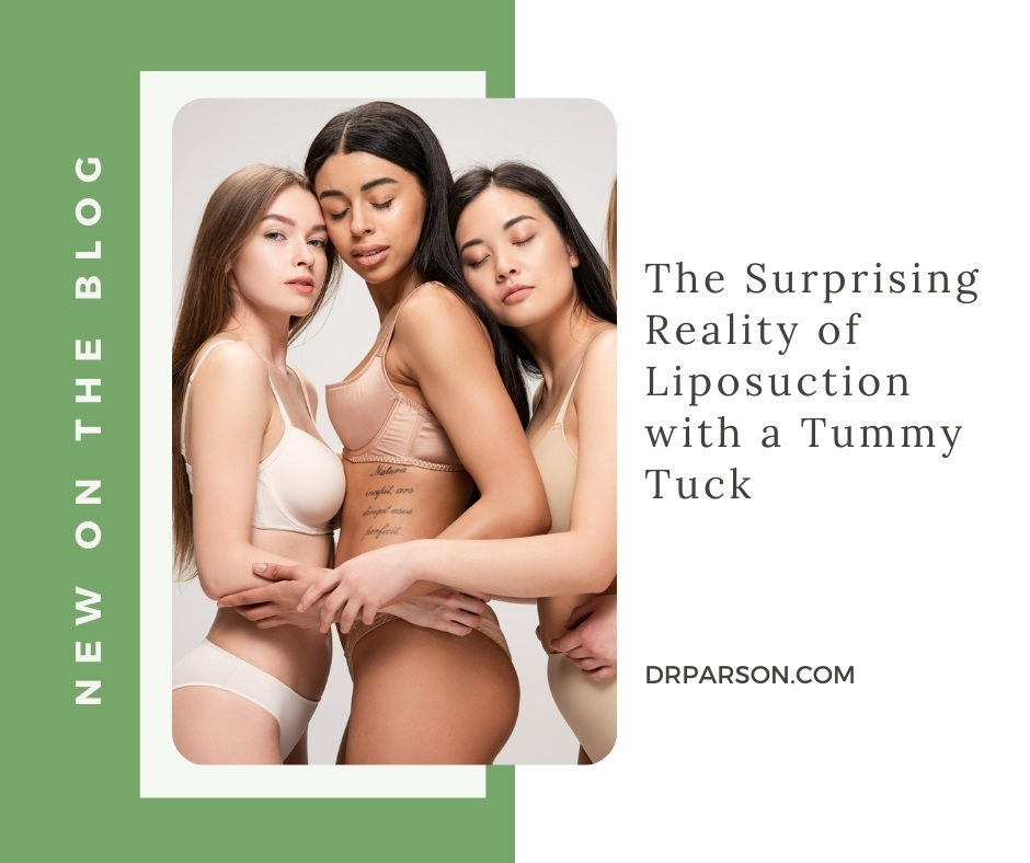 The Surprising Reality of Liposuction with Tummy Tuck | Dr. Shaun Parson
