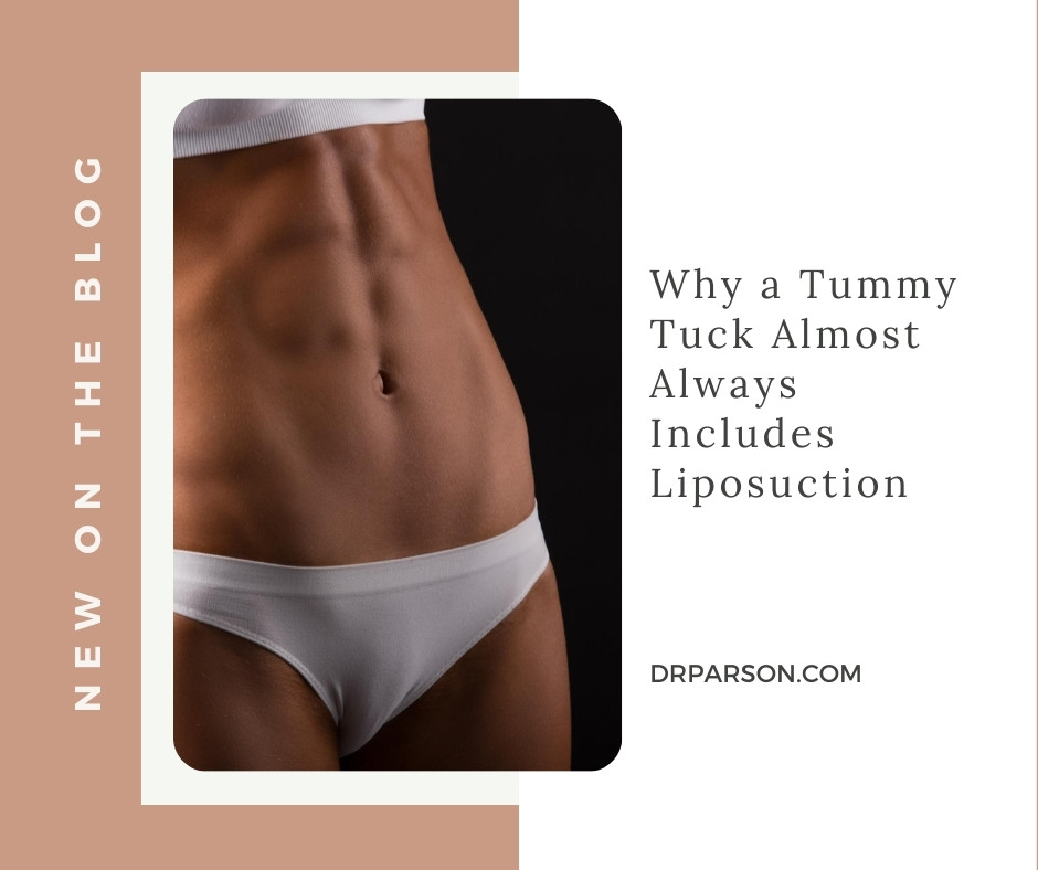 Why a Tummy Tuck Almost Always Includes Liposuction