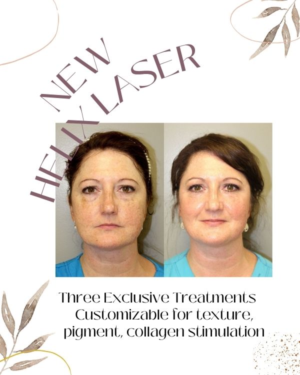 Helix | CoolPeel Laser | Scottsdale, AZ