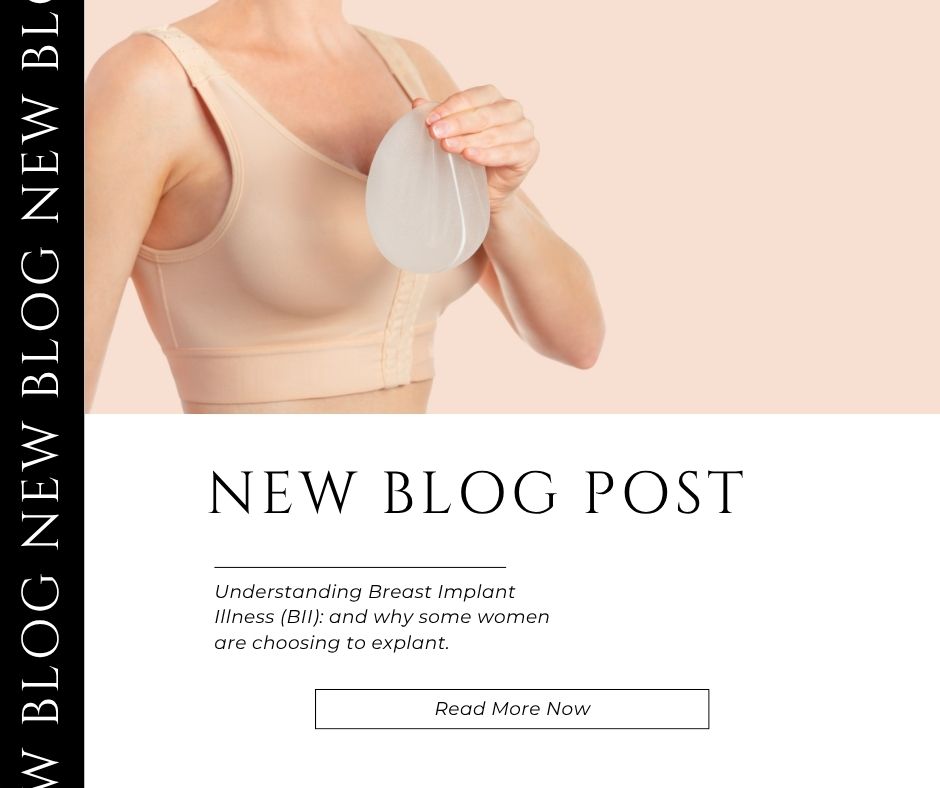 breast implant illness | Dr Shaun Parson