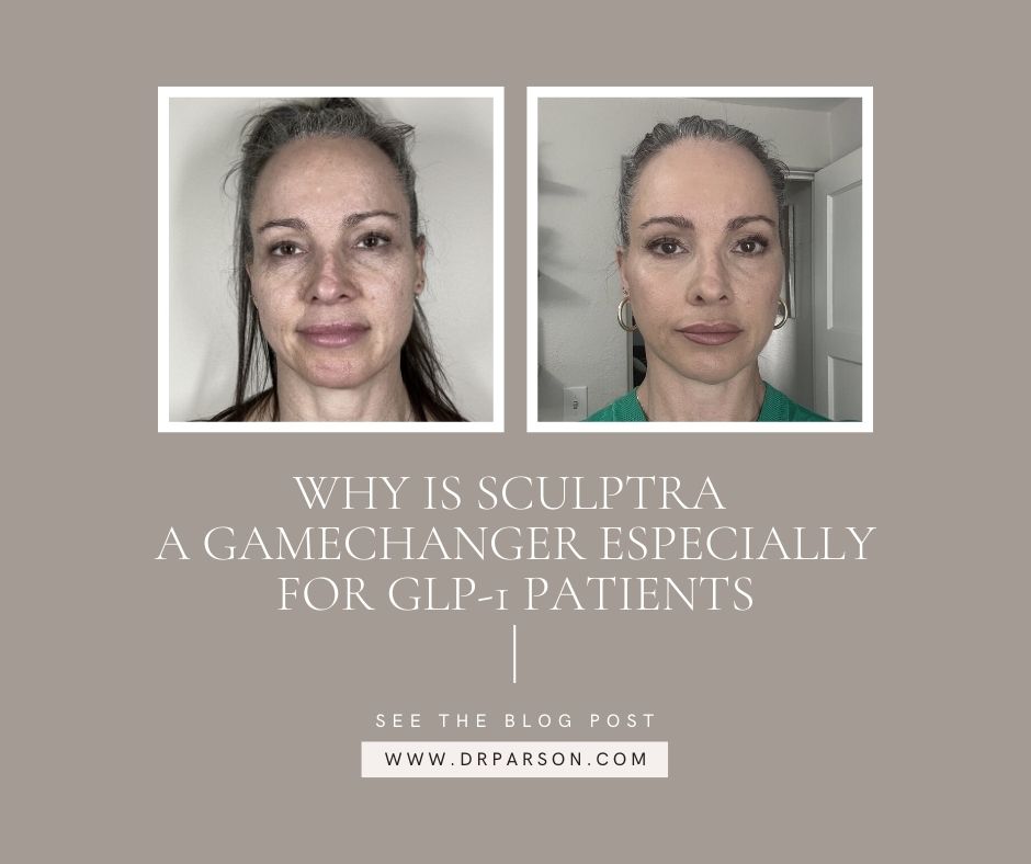 Sculptra and Biostimulators | Scottsdale