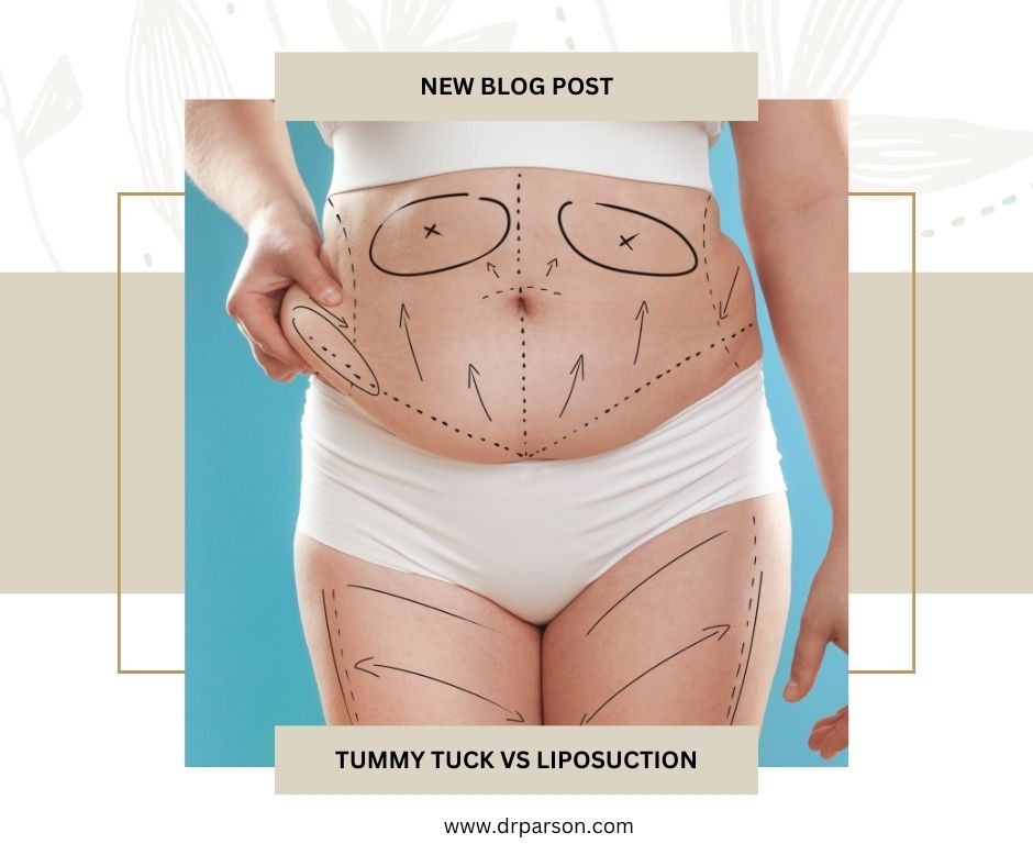 Which hurts more Tummy tuck or liposuction? | Dr. Shaun Parson