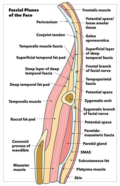 Diagram of facial planes highlighting superficial and deep structures targeted in a deep plane facelift