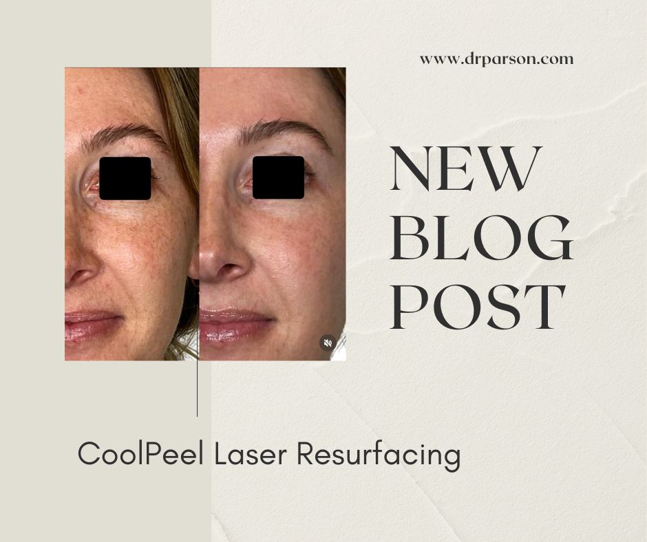 CoolPeel Laser Resurfacing Scottsdale | Parson Skin Center