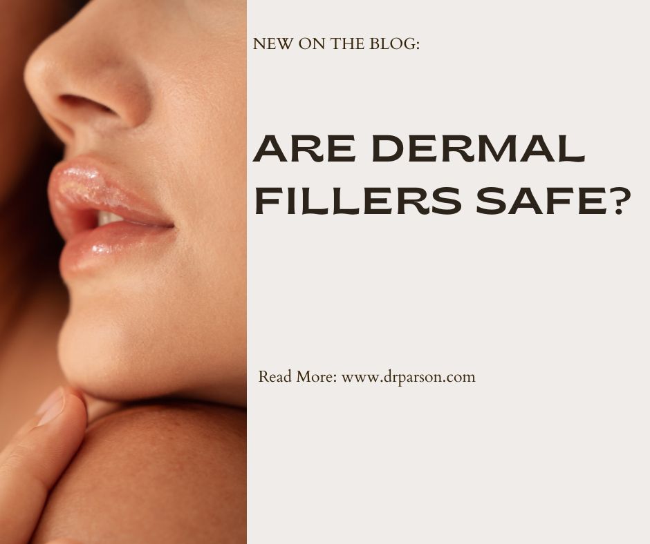 Are Dermal Fillers Safe? | Trusted Scottsdale Injectors