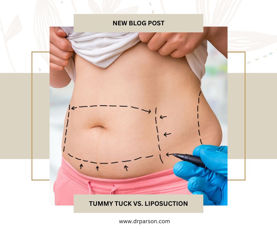 tummy tuck vs lipo scottsdale