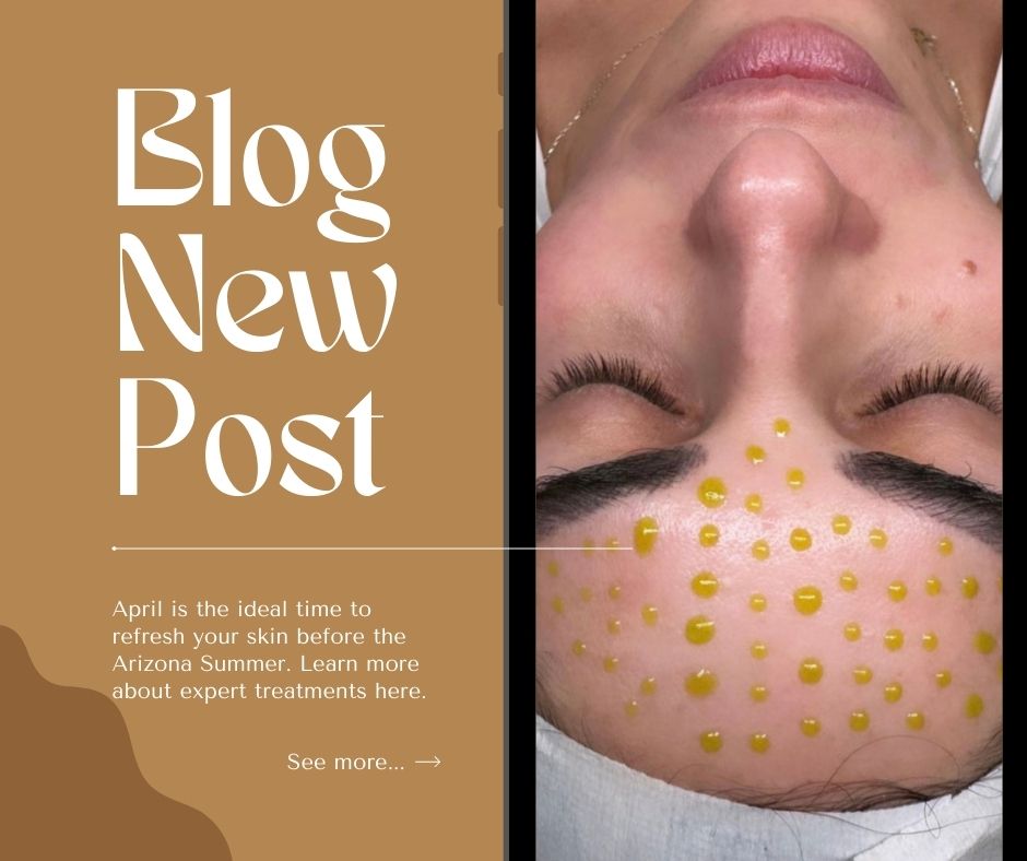 CoolPeel laser treatment improving skin texture in Scottsdale
