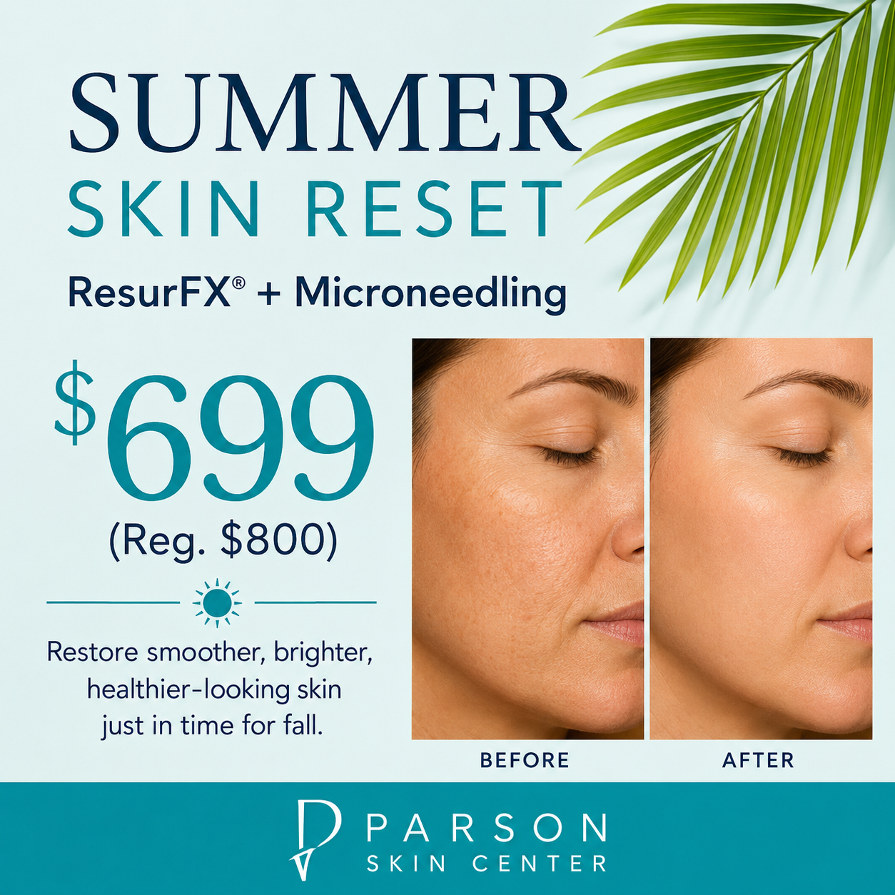 Resurfx + Microneedling | Dr. Shaun Parson