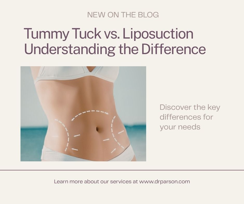 Tummy Tuck vs. Liposuction: Key Differences | Scottsdale