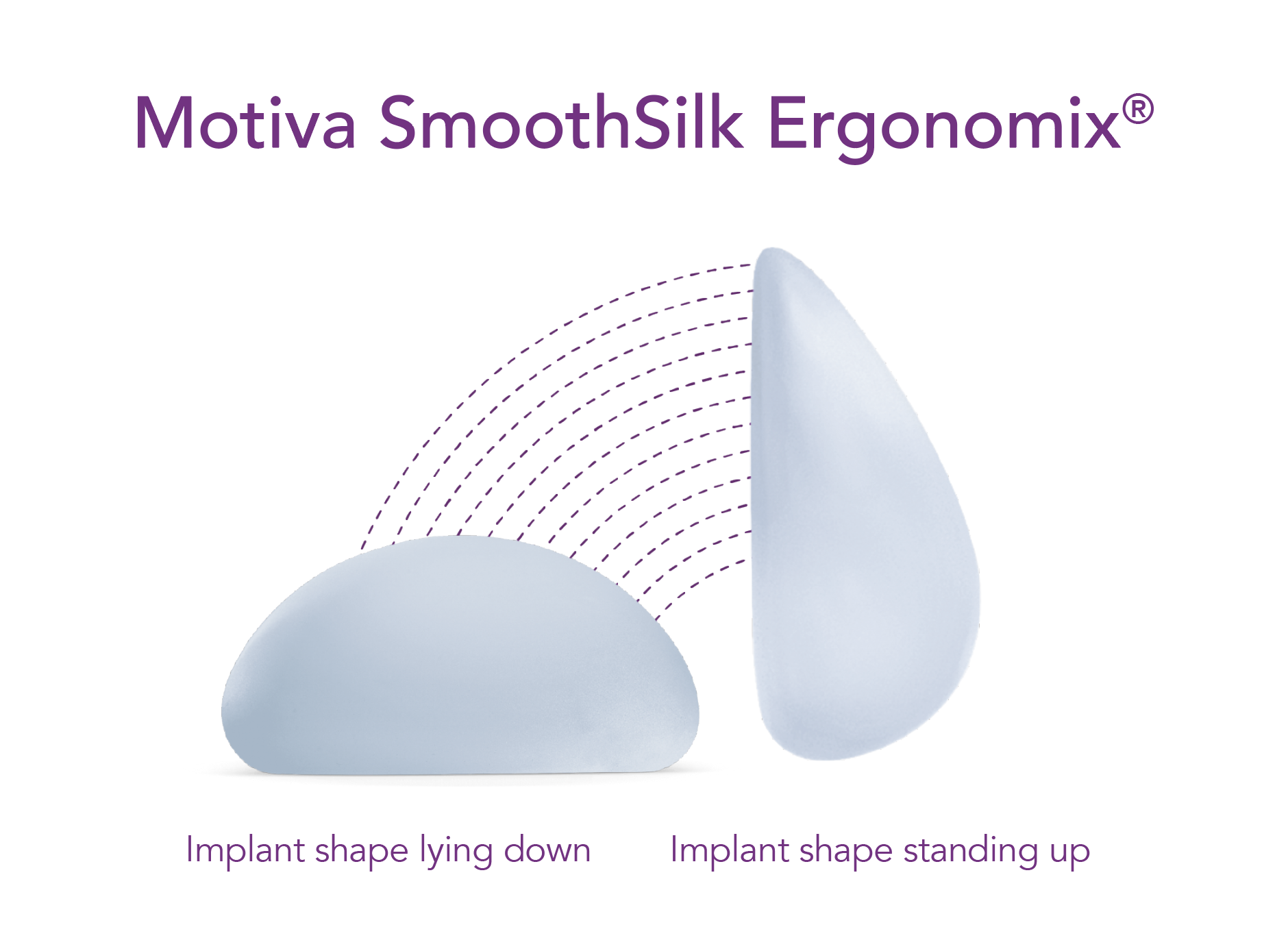 Motiva SmoothSilk Ergonomix implant shape illustrated lying down and standing up