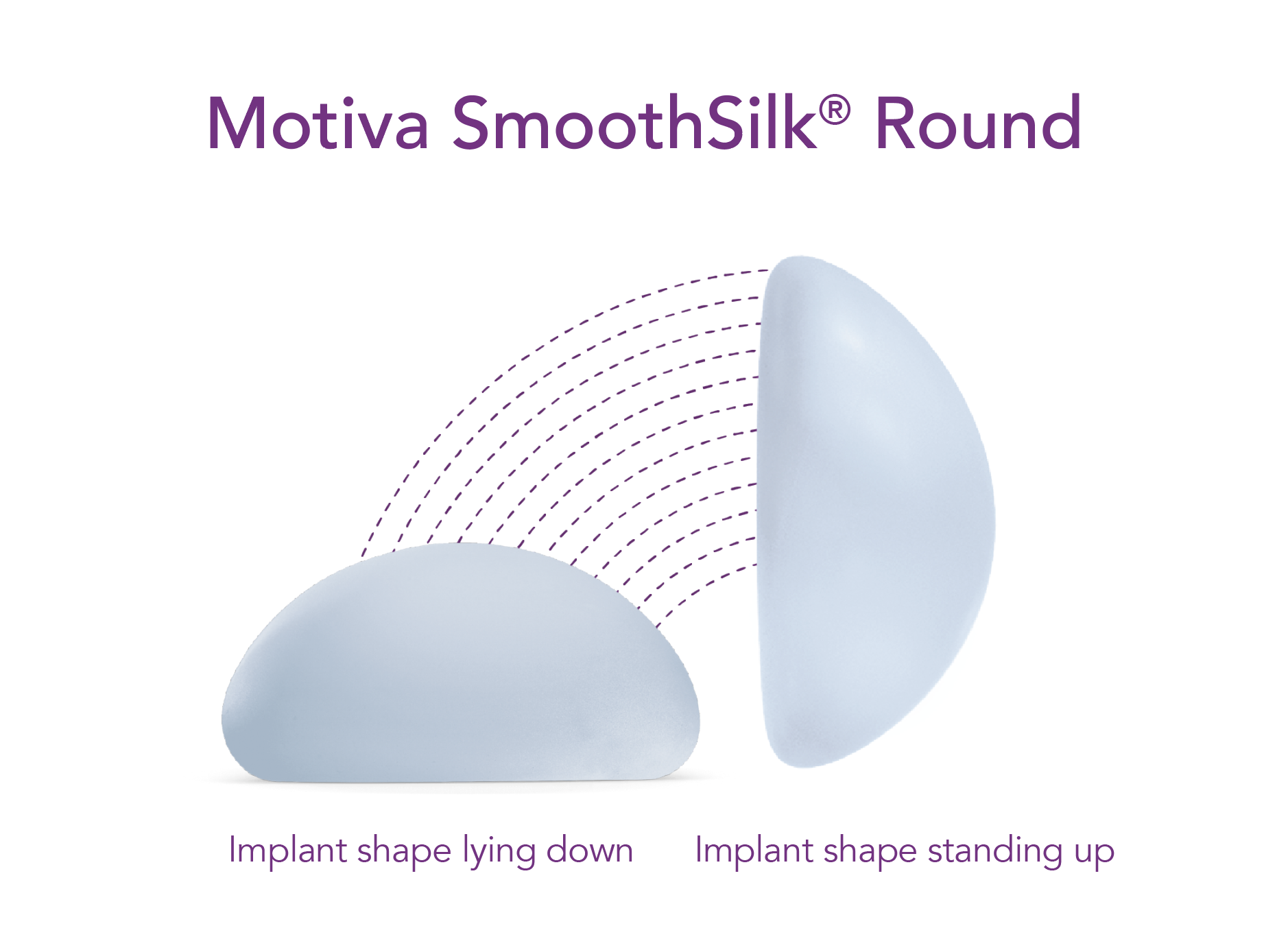 Motiva SmoothSilk Round implant shape illustrated lying down and standing up